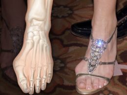 97% of women suffering with bunions have bought shoes & never worn them again