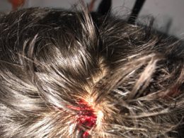 Youths on moped who attacked uniformed officer with hammer caught and arrested in Twickenham