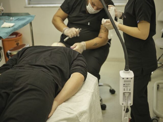 dhi hair transplantation